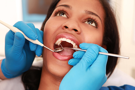 A woman receiving dental care with her mouth open wide.